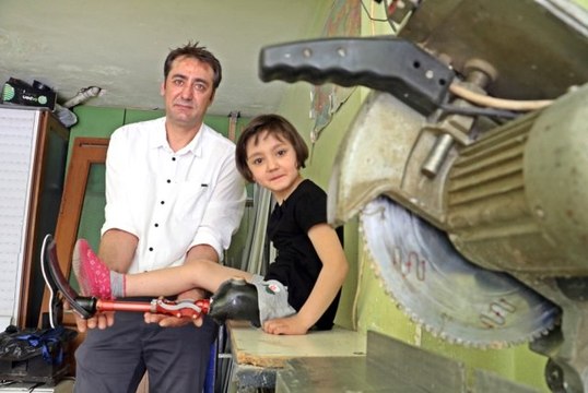 Baba Kalbi Başardı Alüminyum Doğrama Ustası Protez Bacak Üretti