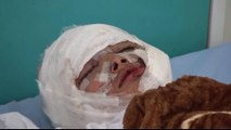 Yemen war: Sanaa air raids victims slam Saudi-UAE coalition