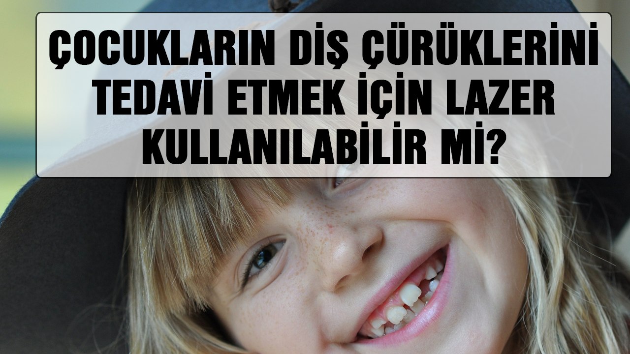 Çocukların Diş Çürüklerini Tedavi Etmek İçin Lazer Kullanılabilir Mi?
