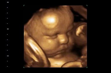 Here is Baby 3D/4D/HD Ultrasound