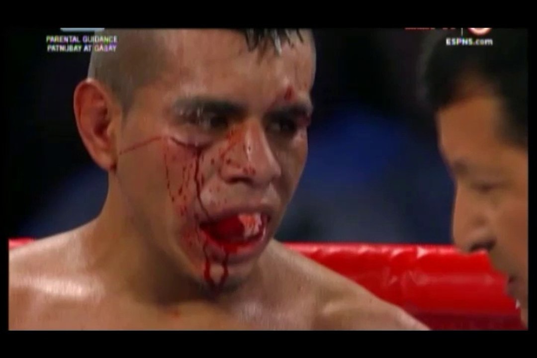 ROMERO DUNO VS JUAN RODRIGUEZ | Boxing