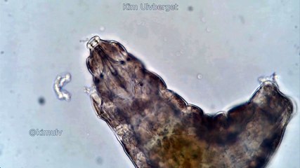 Cute Waterbear In a Microscope - Tardigrades
