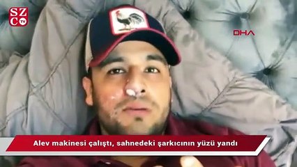 Alev makinesi çalıştı, sahnedeki şarkıcının yüzü yandı