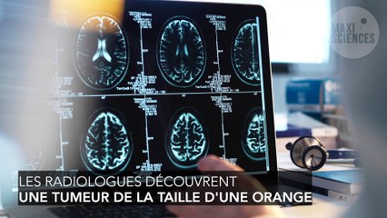 Elle pensait avoir un problème de vue, elle avait une tumeur au cerveau