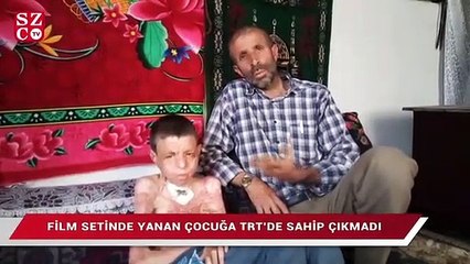 Film setinde yanan çocuğa TRT’de sahip çıkmadı