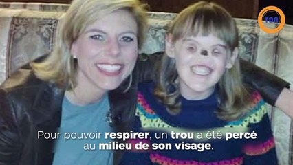 Née sans yeux et sans nez, elle est aujourd’hui diplômée et veut travailler dans les médias !