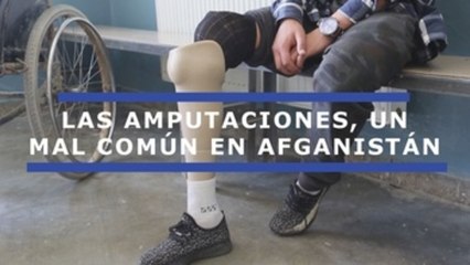 Las amputaciones, un mal común en Afganistán