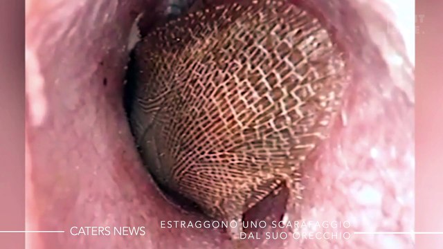 Guardate cosa è uscito dall’orecchio di quest’uomo