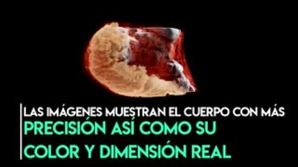 Скачать видео: Negocios | Este escáner muestra los órganos internos del cuerpo humano en 3D