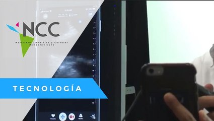 App para ultrasonidos en Smartphones