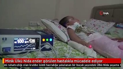 Minik Ülkü Nida ender görülen hastalıkla mücadele ediyor