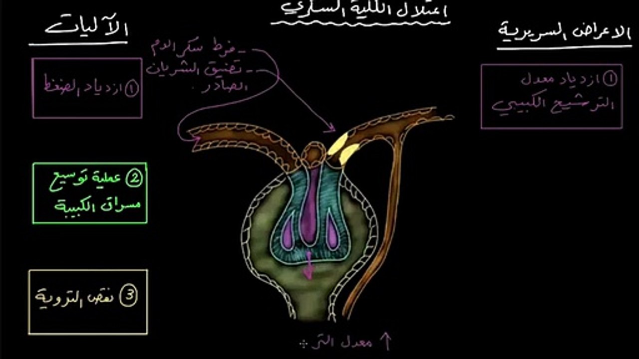 الأعراض السريرية لاعتلال الكلية السُّكري والعلاج