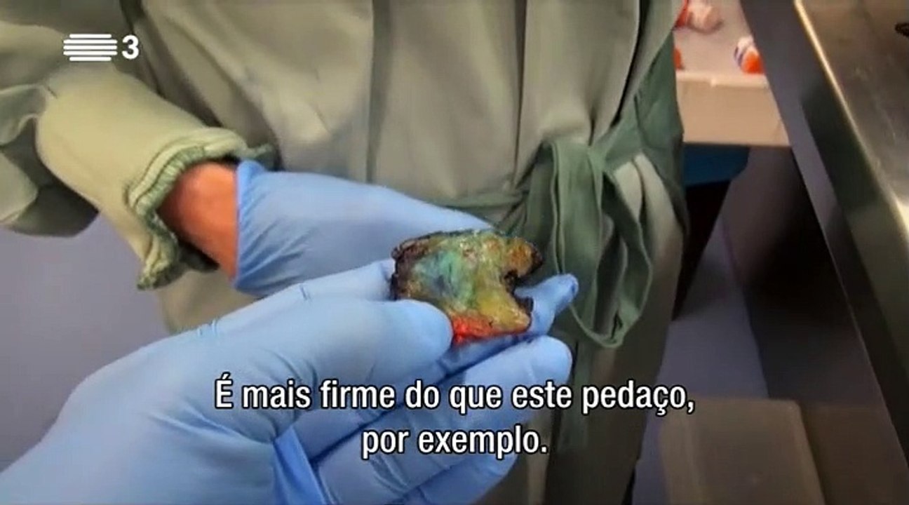 O Meu Cancro (2015) - Documentário