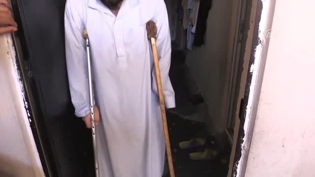 Savaş eşini hayattan kopardı, kendisini sakat bıraktı