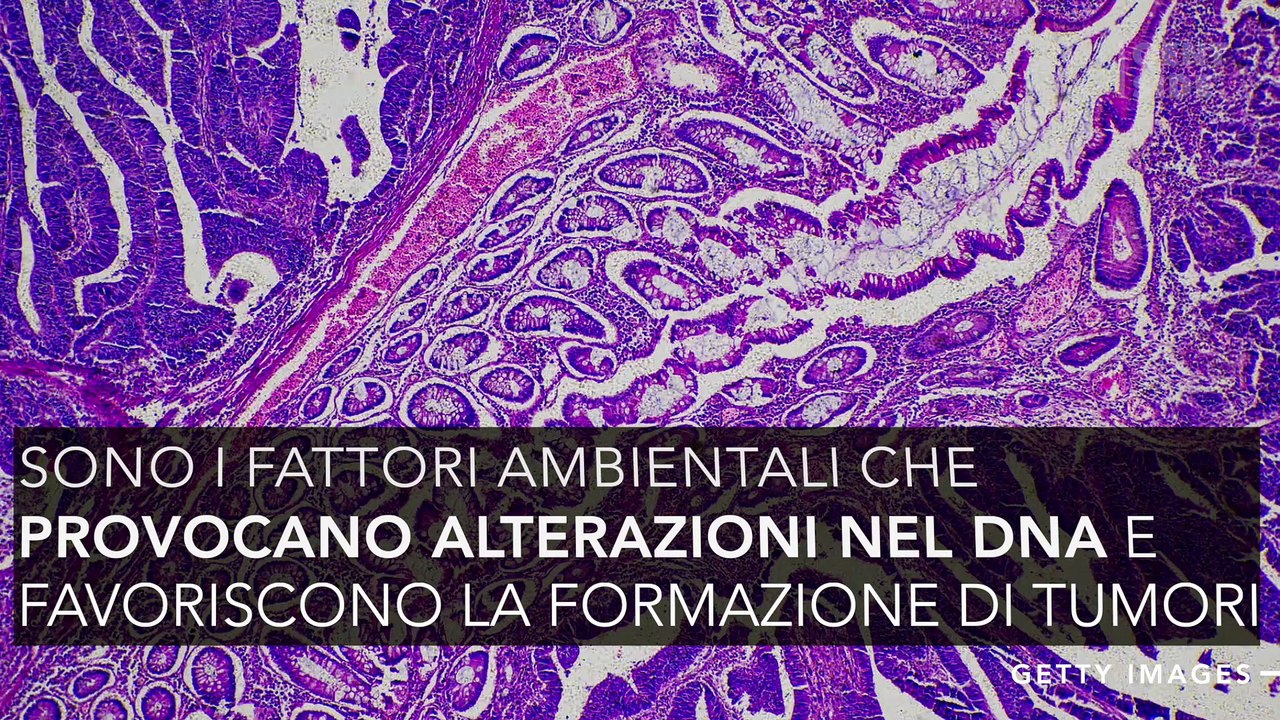 le cause del tumore