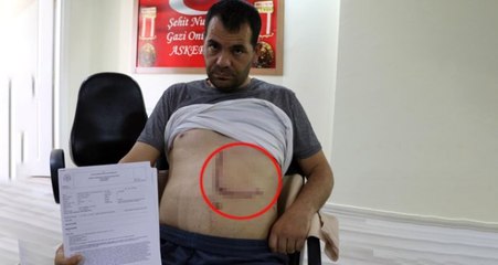 Yaralanan çavuş, 5 yıl boyunca çektiği sancıların nedenini duyunca şaşkına döndü!