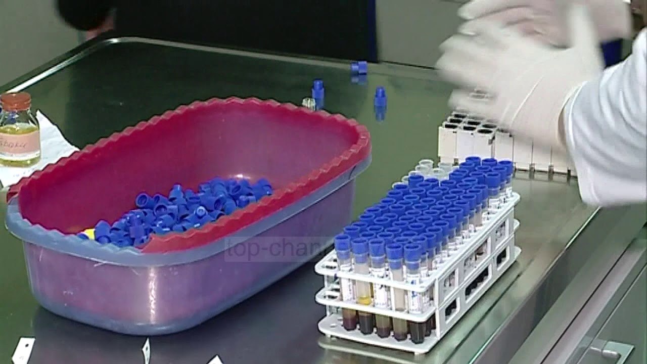 Miratohet koncesioni i laboratorëve  - Top Channel Albania - News - Lajme
