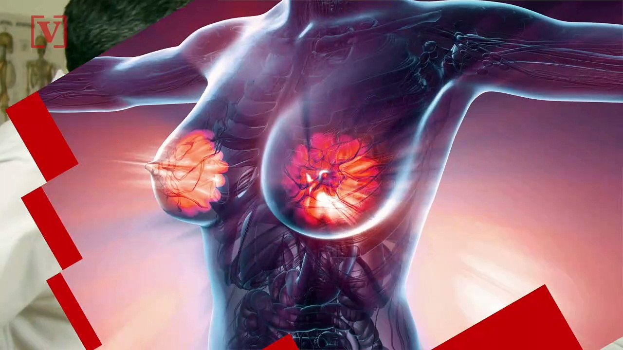 Lowering Your Fat Intake Could Decrease Your Risk of Dying from Breast Cancer