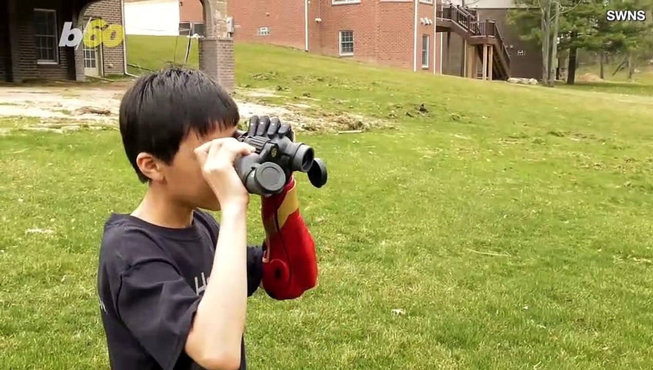 This 10-Year-Old is the Youngest in U.S. to be Fitted With Bionic ‘Iron Man’ Arm