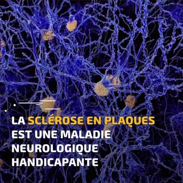 La Minute Santé : sclérose en plaques, une maladie aux symptômes silencieux