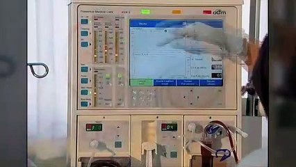 DİYALİZ TEKNİKERLERİNİN ATAMA SORUNU