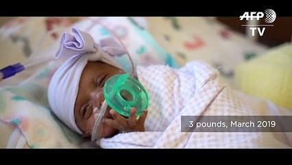 La bebé más pequeña del mundo nace en EEUU: pesó lo mismo que una manzana