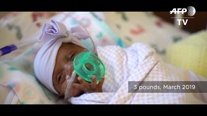 La bebé más pequeña del mundo nace en EEUU: pesó lo mismo que una manzana