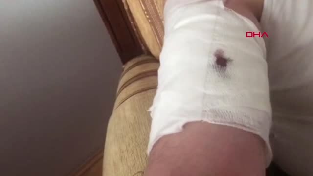 KARS Arpaçay belediye başkanı köpekli saldırıda yaralandı