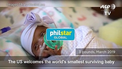 World's smallest surviving baby born in California
