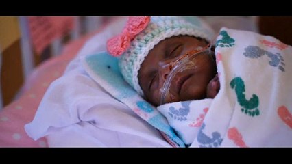 Groß wie ein Apfel, 245 gr leicht: Baby gewinnt Kampf ums Überleben