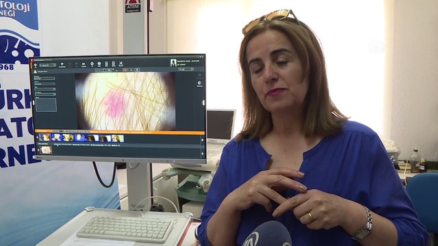 Ücretsiz ben taramasında 'çirkin ördek yavrusu' aranıyor - ANKARA