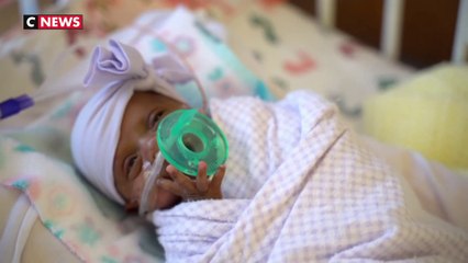 Pesant 245 grammes, le plus petit bébé du monde né vivant, a quitté l'hôpital