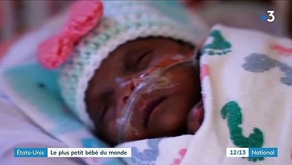États-Unis : Saybie, le plus petit bébé au monde, est sorti de l'hôpital