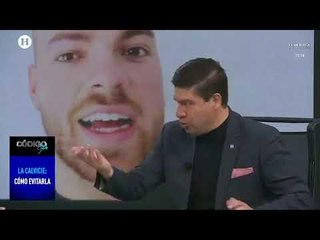 Conoce qué tratamientos ayudan a evitar la calvicie