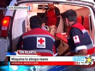 Maquina le atrapa la mano (FUERTES IMAGENES)