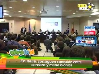 En Italia conectan mano biónica a cerebro  (Vivamundo)