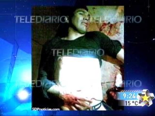 Salvador Cabañas baleado (fuertes imagenes)