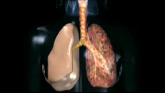 Internacional | La contaminación puede afectar el cerebro