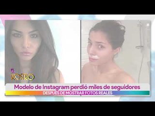 Modelo pierde seguidores por mostrar su otra cara | Vivalavi