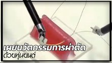 เผยนวัตกรรม การผ่าตัด ด้วยโรบอท ทำกันอย่างไร !? มาดูกัน