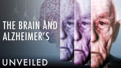 What Happens To The Brain During Alzheimer's?
