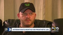 Valley veteran waits months for prosthetic leg