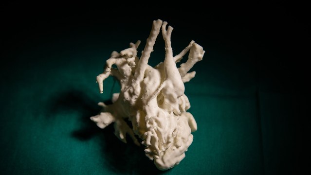 Así se hacen y así se opera con corazones imprimidos en 3D