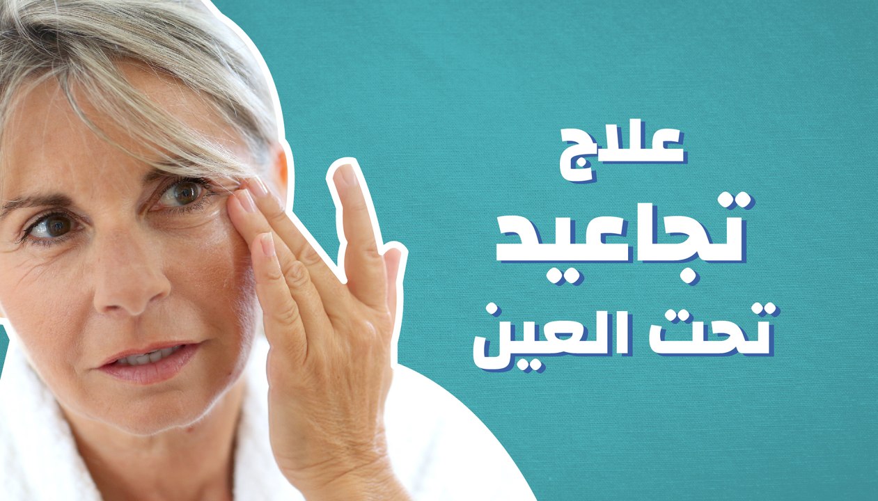 علاج تجاعيد تحت العين: كيف يتم؟