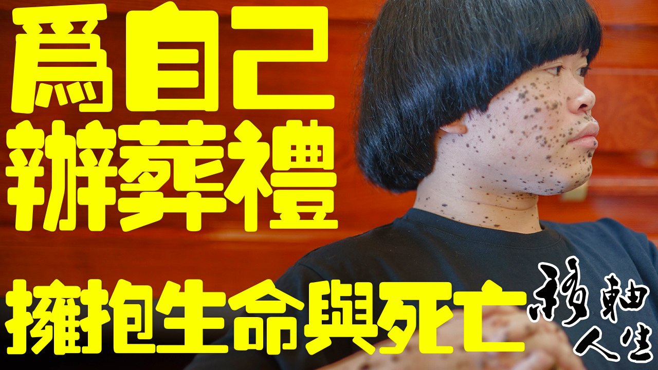 在兒時被診斷患有癌症活不久的斑點人陳偉霖在30歲那年為自己辦了「葬禮」，通過自己的葬禮，擁抱一...