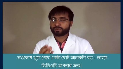অণ্ডকোষ ঝুলে গেছে একটা ছোট আরেকটা বড় - তাহলে ভিডিওটি আপনার জন্য।