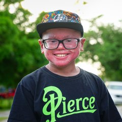 The Teen Whose Skin Grows Too Fast | BORN DIFFERENT