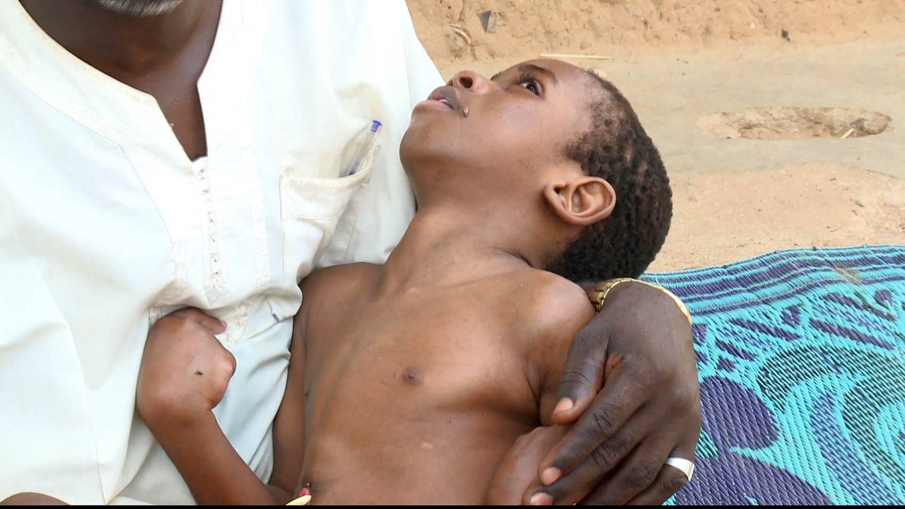 Children at risk in Nigeria due to lead poisoning from gold mines