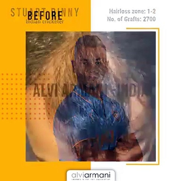 Stuart Binny Indian Cricketer