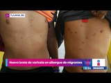 Detectan nuevo brote de varicela en albergue de migrantes | Noticias con Yuriria Sierra
